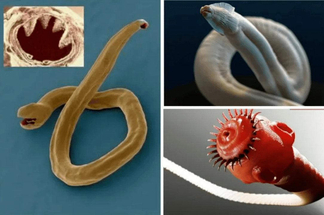 Worm Parasites In Human Body