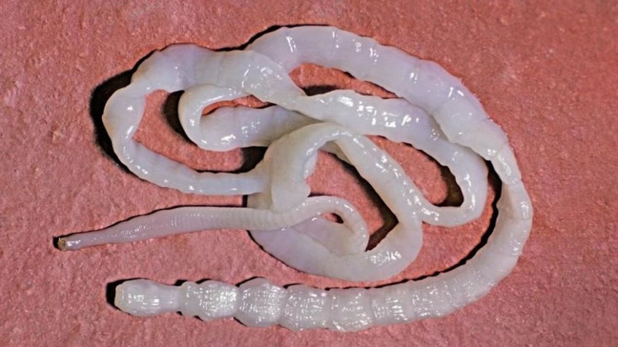 intracavitary tapeworm