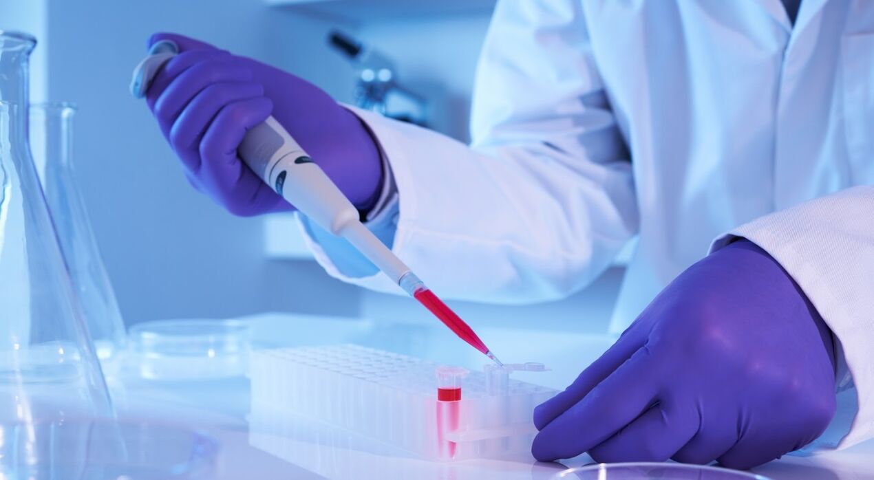 How to perform parasite analysis