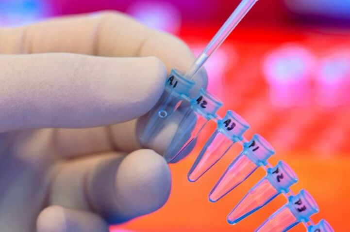What has been handed over for the parasite test