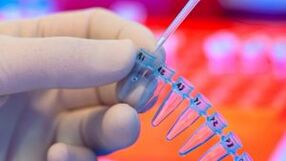 How to take a parasite test