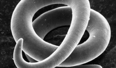 Human parasites photos