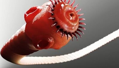 Types of parasites in humans