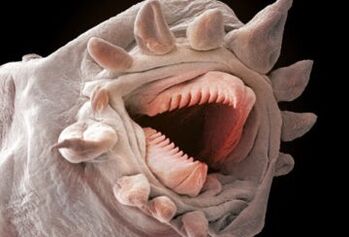 What bugs can live in the human body