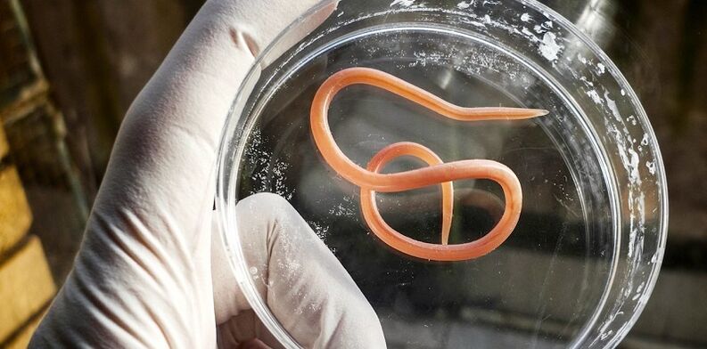 Parasites from the human body