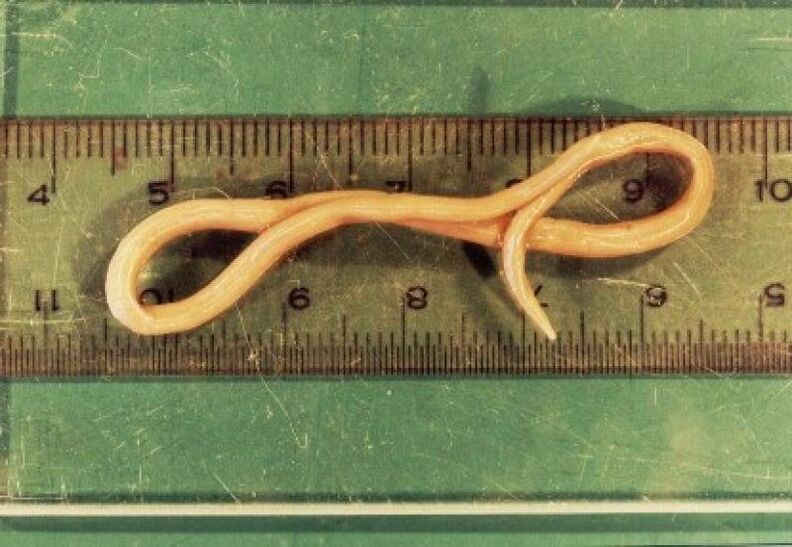 Roundworm parasites from humans
