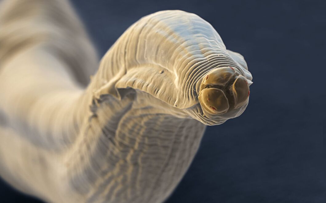 Toxocara from humans
