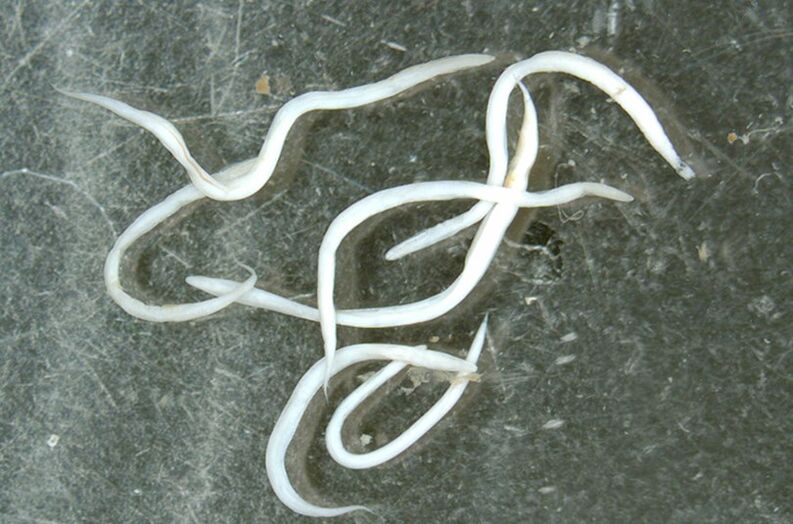 helminth parasites from human body