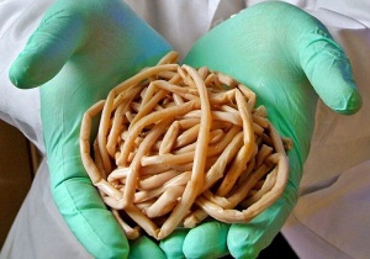Parasites from the human body