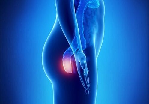 Rectal pruritus as an indication for parasite testing