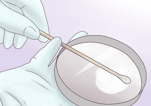 Smear test for parasites