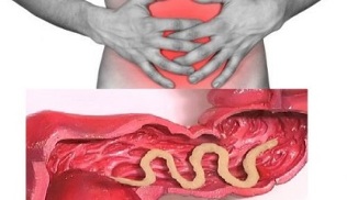 Symptoms of parasites in the human intestine