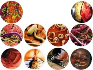 How to remove parasites from the body through folk remedies