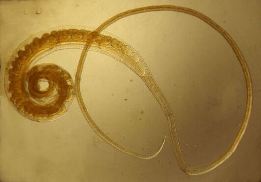 Trichinella worm from human body